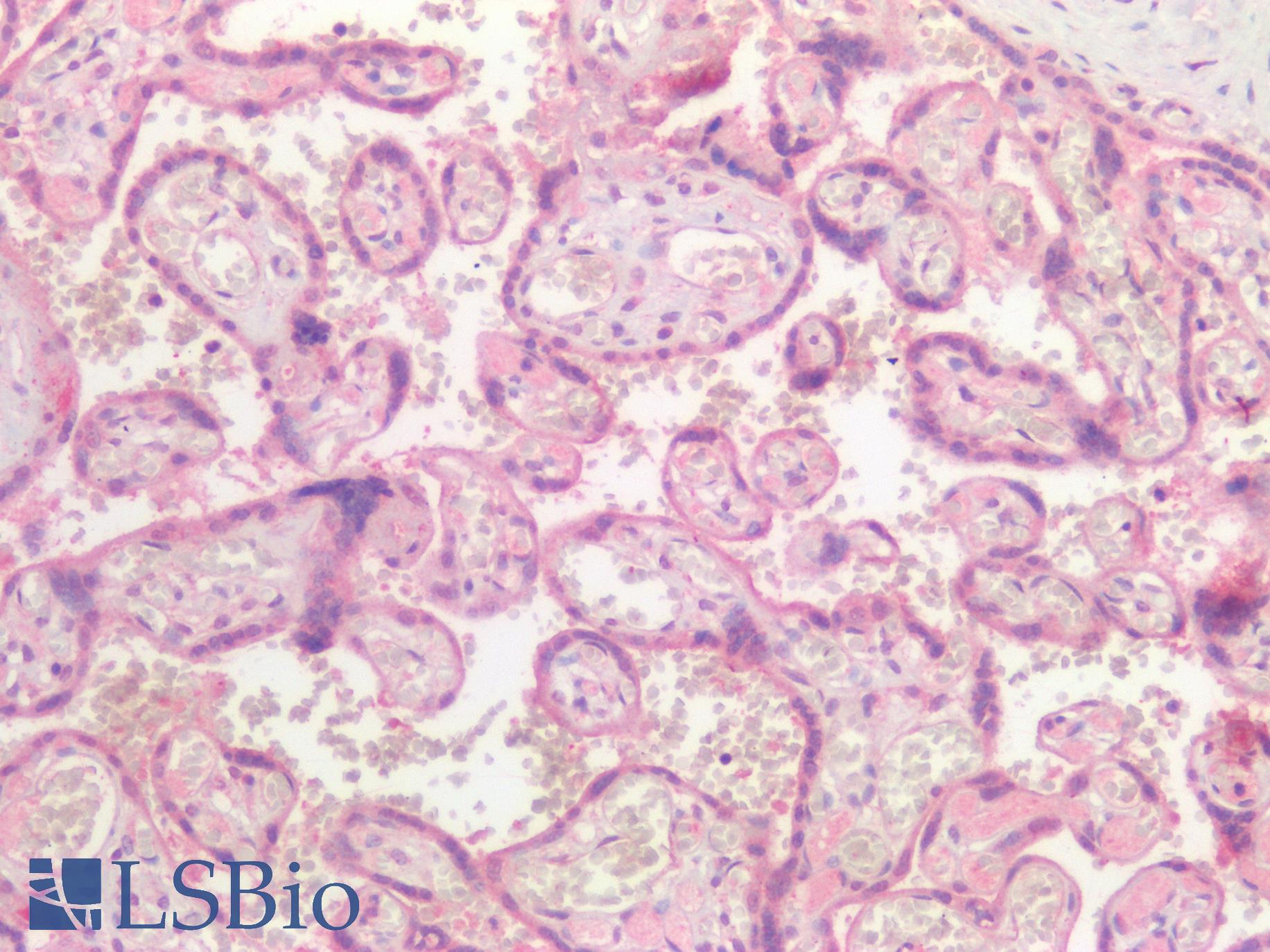 TNFRSF1B / TNFR2 Antibody - Human Placenta: Formalin-Fixed, Paraffin-Embedded (FFPE)