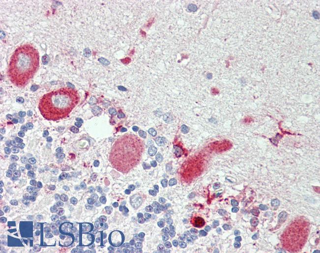 TNFRSF21 / DR6 Antibody - Anti-TNFRSF21 / DR6 antibody IHC staining of human brain, cerebellum. Immunohistochemistry of formalin-fixed, paraffin-embedded tissue after heat-induced antigen retrieval. Antibody dilution 1:75.