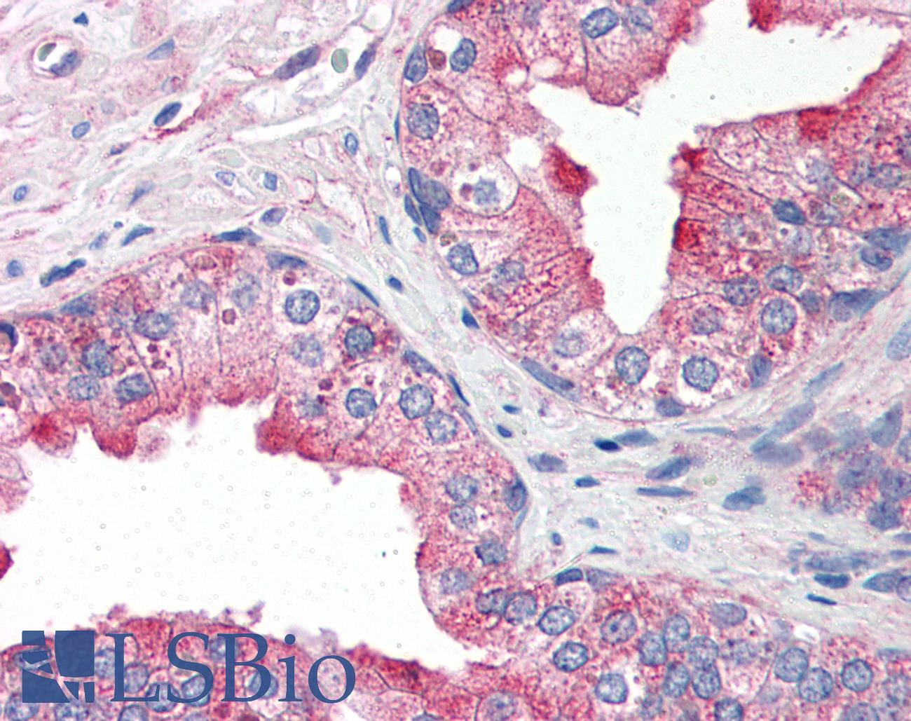 TNFRSF25 / DR3 Antibody - Anti-DR3 antibody IHC of human prostate. Immunohistochemistry of formalin-fixed, paraffin-embedded tissue after heat-induced antigen retrieval. Antibody concentration 10 ug/ml.