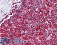 TNFRSF4 / CD134 / OX40 Antibody - Human Spleen: Formalin-Fixed, Paraffin-Embedded (FFPE)