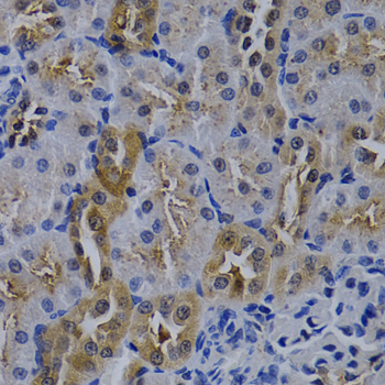 TNFRSF6B / DCR3 Antibody - Immunohistochemistry of paraffin-embedded rat kidney tissue at 1:200 dilution.