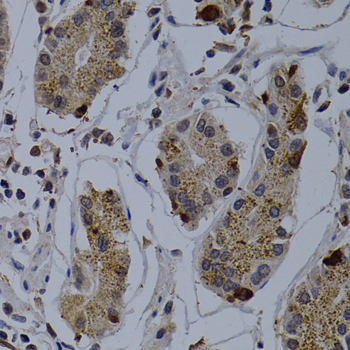 TNFRSF6B / DCR3 Antibody - Immunohistochemistry of paraffin-embedded human normal stomach tissue at 1:200 dilution.