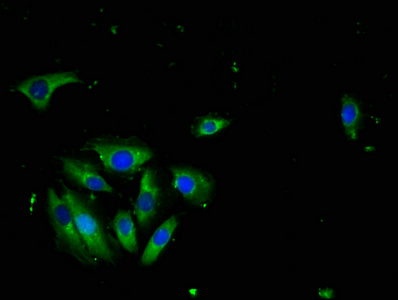 TNFSF10 / TRAIL Antibody - Immunofluorescence staining of A549 cells with TNFSF10 Antibody at 1:100, counter-stained with DAPI. The cells were fixed in 4% formaldehyde, permeabilized using 0.2% Triton X-100 and blocked in 10% normal Goat Serum. The cells were then incubated with the antibody overnight at 4°C. The secondary antibody was Alexa Fluor 488-congugated AffiniPure Goat Anti-Rabbit IgG(H+L).