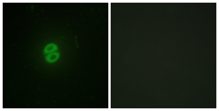 TNFSF10 / TRAIL Antibody - Immunofluorescence analysis of A549 cells, using CD253 Antibody. The picture on the right is blocked with the synthesized peptide.