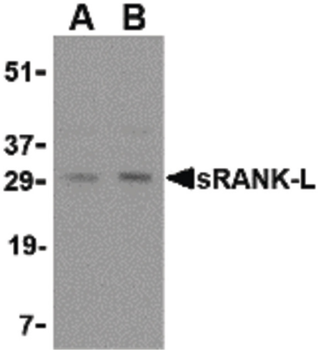 TNFSF11 / RANKL / TRANCE Antibody - Western blot of sRANK-L in rat liver tissue lysate with sRANK-L antibody at (A) 0.25 and (B) 0.5 ug/ml.