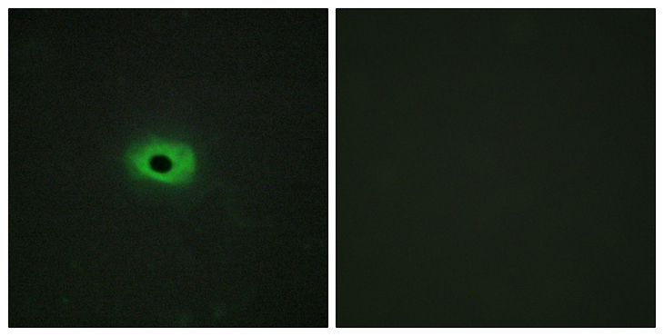 TNFSF12 / TWEAK Antibody - Immunofluorescence analysis of HeLa cells, using TNF12 Antibody. The picture on the right is blocked with the synthesized peptide.