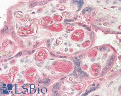 TNFSF12 / TWEAK Antibody - Human Placenta: Formalin-Fixed, Paraffin-Embedded (FFPE)