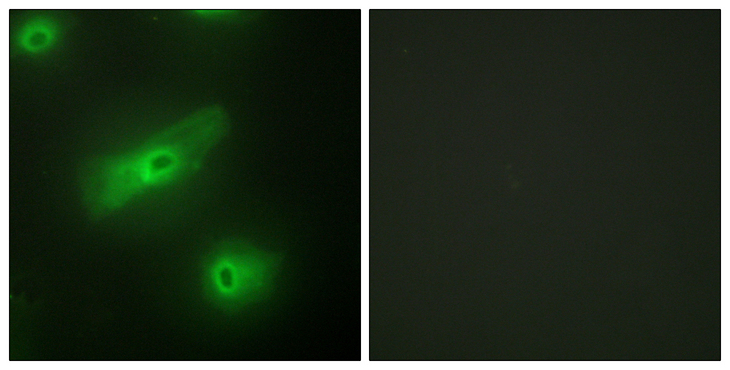 TNFSF13 / APRIL Antibody - Immunofluorescence analysis of HeLa cells, using TALL-2 Antibody. The picture on the right is blocked with the synthesized peptide.