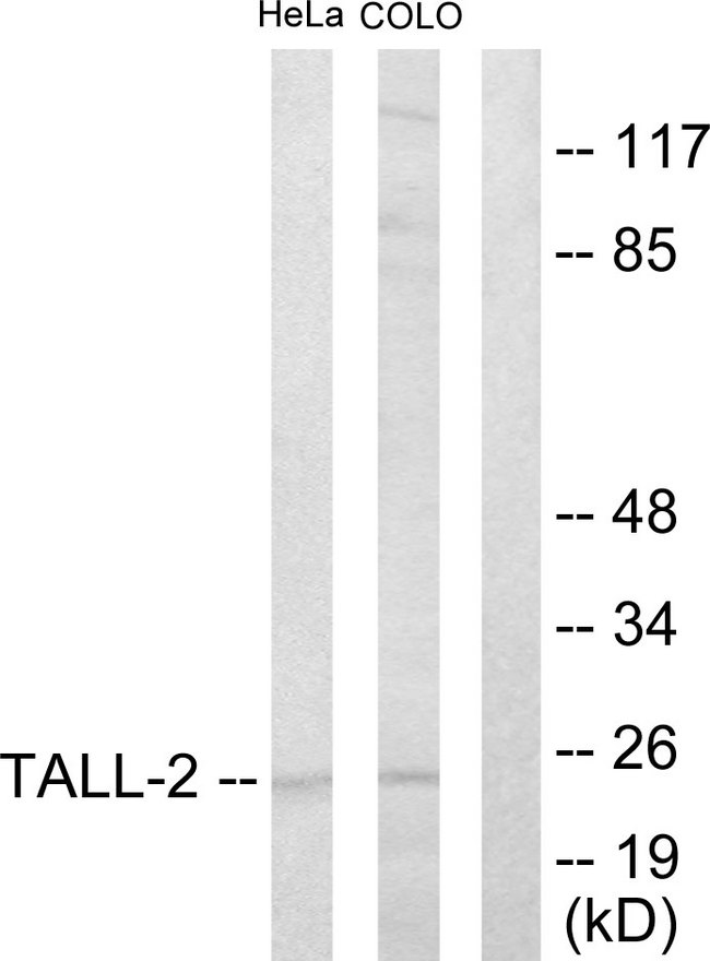 TNFSF13 / APRIL Antibody - Western blot analysis of lysates from HeLa and COLO205 cells, using TALL-2 Antibody. The lane on the right is blocked with the synthesized peptide.