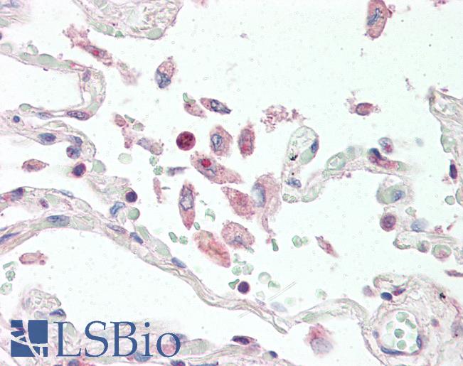 TNFSF13 / APRIL Antibody - Anti-APRIL antibody IHC of human lung. Immunohistochemistry of formalin-fixed, paraffin-embedded tissue after heat-induced antigen retrieval. Antibody concentration 10 ug/ml.