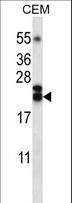 TNFSF4 / OX40L / CD252 Antibody - TNFSF4 Antibody western blot of CEM cell line lysates (35 ug/lane). The TNFSF4 antibody detected the TNFSF4 protein (arrow).