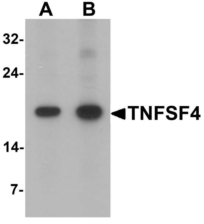 TNFSF4 / OX40L / CD252 Antibody - Western blot analysis of TNFSF4 in rat spleen tissue lysate with TNFSF4 antibody at (A) 0.5 and (B) 1 ug/ml