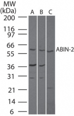 TNIP2 / ABIN-2 Antibody - Western blot of ABIN-2 in A) human brain, B) mouse brain and C) rat brain lysate using antibody at 3 ug/ml.