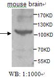 TNK2 / ACK1 Antibody