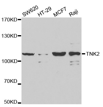 TNK2 / ACK1 Antibody - Western blot analysis of extracts of various cell lines, using TNK2 antibody.