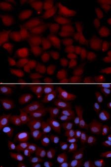 TNK2 / ACK1 Antibody - Immunofluorescence analysis of U2OS cell using TNK2 antibody. Blue: DAPI for nuclear staining.