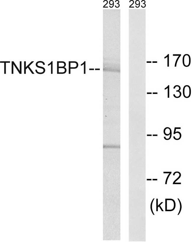 TNKS1BP1 / TAB182 Antibody - Western blot analysis of lysates from 293 cells, using TNKS1BP1 Antibody. The lane on the right is blocked with the synthesized peptide.
