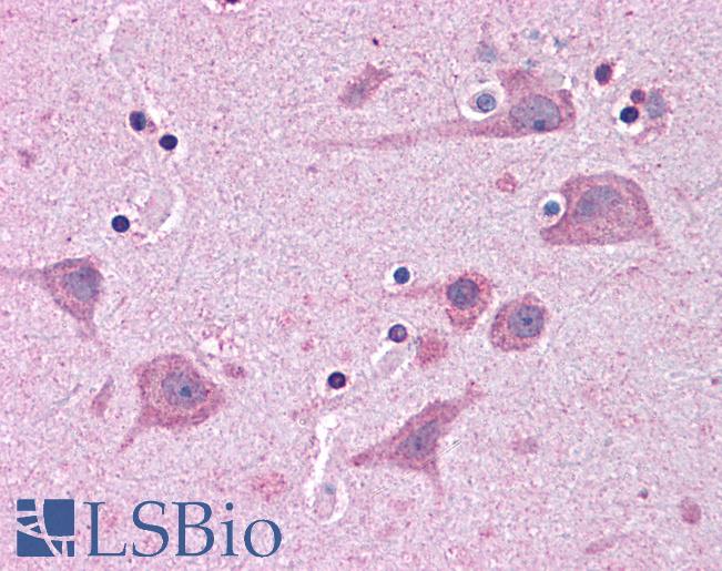 TNKS1BP1 / TAB182 Antibody - Anti-TNKS1BP1 antibody IHC of human brain, cortex. Immunohistochemistry of formalin-fixed, paraffin-embedded tissue after heat-induced antigen retrieval. Antibody concentration 5 ug/ml.