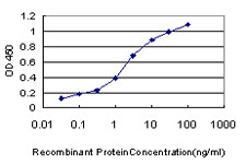 TNNC1 / Cardiac Troponin C Antibody - Detection limit for recombinant GST tagged TNNC1 is approximately 0.03 ng/ml as a capture antibody.