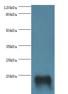 TNNC2 Antibody - Western blot. All lanes: TNNC2 antibody at 10 ug/ml+mouse skeletal muscle. Secondary antibody: Goat polyclonal to rabbit at 1:10000 dilution. Predicted band size: 18 kDa. Observed band size: 18 kDa Immunohistochemistry.