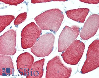 TNNC2 Antibody - Human Skeletal Muscle: Formalin-Fixed, Paraffin-Embedded (FFPE), at a concentration of 10 ug/ml. 
