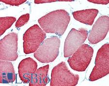 TNNC2 Antibody - Human Skeletal Muscle: Formalin-Fixed, Paraffin-Embedded (FFPE), at a concentration of 10 ug/ml. 