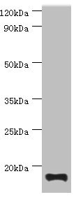 TNNC2 Antibody - Western blot All lanes: TNNC2 antibody at 10µg/ml + Mouse skeletal muscle tissue Secondary Goat polyclonal to rabbit IgG at 1/10000 dilution Predicted band size: 18 kDa Observed band size: 18 kDa