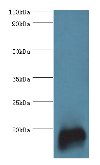 TNNC2 Antibody - Western blot. All lanes: TNNC2 antibody at 10 ug/ml+mouse skeletal muscle tissue. Secondary antibody: Goat polyclonal to rabbit at 1:10000 dilution. Predicted band size: 18 kDa. Observed band size: 18 kDa.