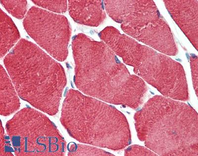 TNNC2 Antibody - Human Skeletal Muscle: Formalin-Fixed, Paraffin-Embedded (FFPE), at a concentration of 10 ug/ml.
