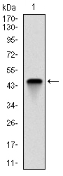 TNNI2 Antibody - Western blot using TNNI2 monoclonal antibody against human TNNI2 (AA: 1-182) recombinant protein. (Expected MW is 21 kDa)