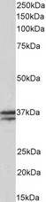 TNNT1 / TNT Antibody - Goat Anti-TNNT1 Antibody (0.03µg/ml) staining of Human Skeletal Muscle lysate (35µg protein in RIPA buffer). Primary incubation was 1 hour. Detected by chemiluminescencence.
