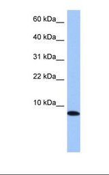 TNP1 / TP1 Antibody - 721_B cell lysate. Antibody concentration: 1.0 ug/ml. Gel concentration: 10-20%.  This image was taken for the unconjugated form of this product. Other forms have not been tested.
