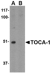 TOCA1 / FNBP1L Antibody - Western blot of TOCA-1 in mouse brain tissue lysate with in (A) the absence and (B) the presence of blocking peptide with TOCA-1 antibody at 1 ug/ml. Below: Immunohistochemistry of TOCA-1 in human brain tissue with TOCA-1 antibody at 2.5 ug/ml.