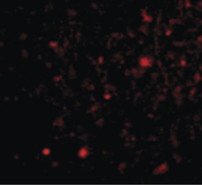 TOCA1 / FNBP1L Antibody - Immunofluorescence of TOCA-1 in Human Brain cells with TOCA-1 antibody at 20 ug/ml.