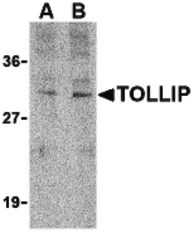 TOLLIP Antibody - Western blot of TOLLIP in rat brain cell lysate with TOLLIP antibody at (A) 1 and (B) 2 ug/ml.
