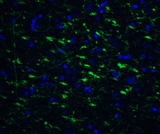 TOLLIP Antibody - Immunofluorescence of TOLLIP in human brain tissue with TOLLIP antibody at 20 ug/ml.  Green: TOLLIP Antibody  Blue: DAPI staining