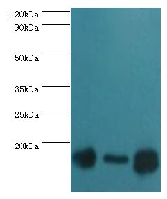 TOMM20 Antibody - Western blot. All lanes: Mitochondrial import receptor subunit TOM20 homolog antibody at 3 ug/ml. Lane 1: mouse brain tissue. Lane 2: HeLa whole cell lysate. Lane 3: mouse liver tissue. secondary Goat polyclonal to rabbit at 1:10000 dilution. Predicted band size: 16 kDa. Observed band size: 16 kDa.