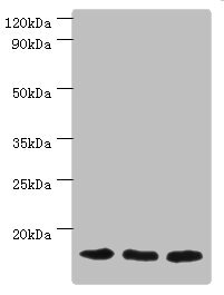 TOMM20 Antibody - Western blot All lanes: Mitochondrial import receptor subunit TOM20 homolog antibody at 3µg/ml Lane 1: Mouse brain tissue Lane 2: Hela whole cell lysate Lane 3: Mouse liver tissue Secondary Goat polyclonal to rabbit IgG at 1/10000 dilution Predicted band size: 16 kDa Observed band size: 16 kDa