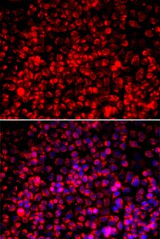 TOMM20 Antibody - Immunofluorescence analysis of A549 cells.