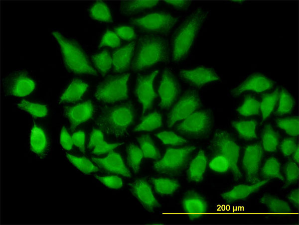 TOMM22 / TOM22 Antibody - Immunofluorescence of monoclonal antibody to TOMM22 on HeLa cell. [antibody concentration 10 ug/ml]