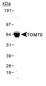 TOMM70A Antibody - Detection of TOM70A in MCF-7 lysates with TOMM70A Antibody. This image was taken for the unconjugated form of this product. Other forms have not been tested.