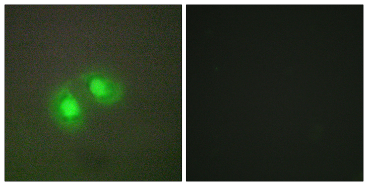 TOP2A / Topoisomerase II Alpha Antibody - Immunofluorescence analysis of A549 cells, using TOP2A Antibody. The picture on the right is blocked with the synthesized peptide.