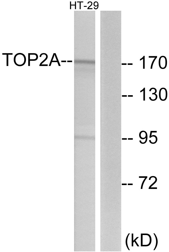 TOP2A / Topoisomerase II Alpha Antibody - Western blot analysis of lysates from HT-29 cells, using TOP2A Antibody. The lane on the right is blocked with the synthesized peptide.
