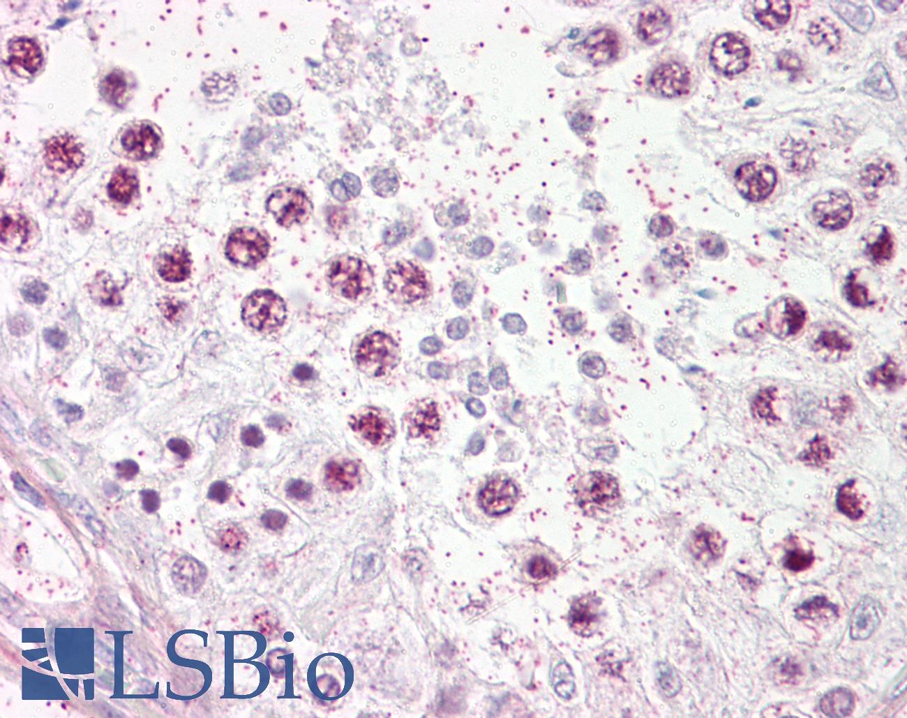 TOP2A / Topoisomerase II Alpha Antibody - Anti-TOP2A antibody IHC of human testis. Immunohistochemistry of formalin-fixed, paraffin-embedded tissue after heat-induced antigen retrieval. Antibody dilution 1:100.