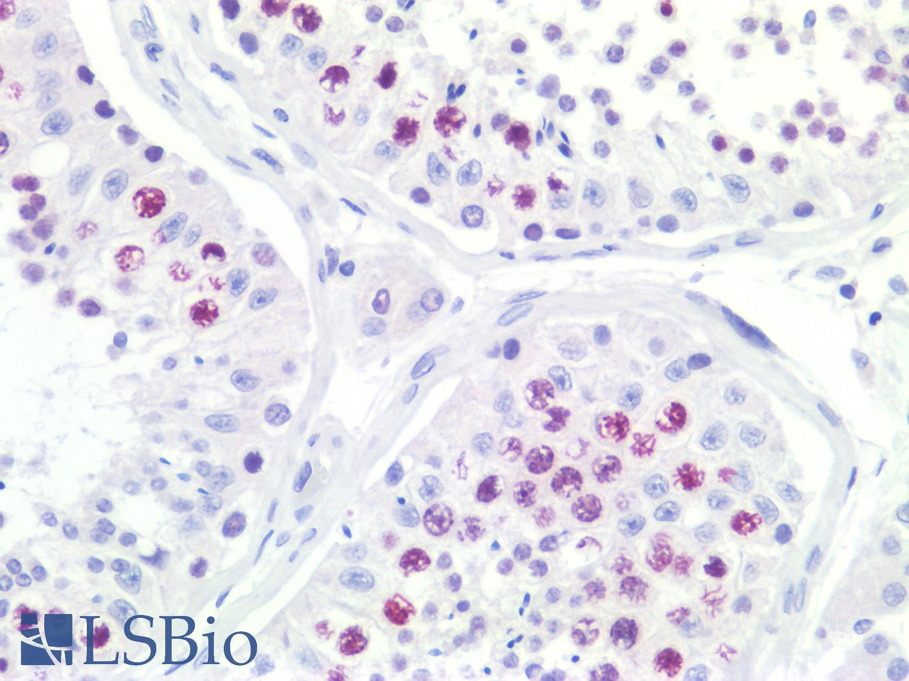 TOP2A / Topoisomerase II Alpha Antibody - Human Testis: Formalin-Fixed, Paraffin-Embedded (FFPE)