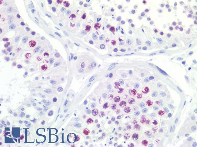 TOP2A / Topoisomerase II Alpha Antibody - Human Testis: Formalin-Fixed, Paraffin-Embedded (FFPE)