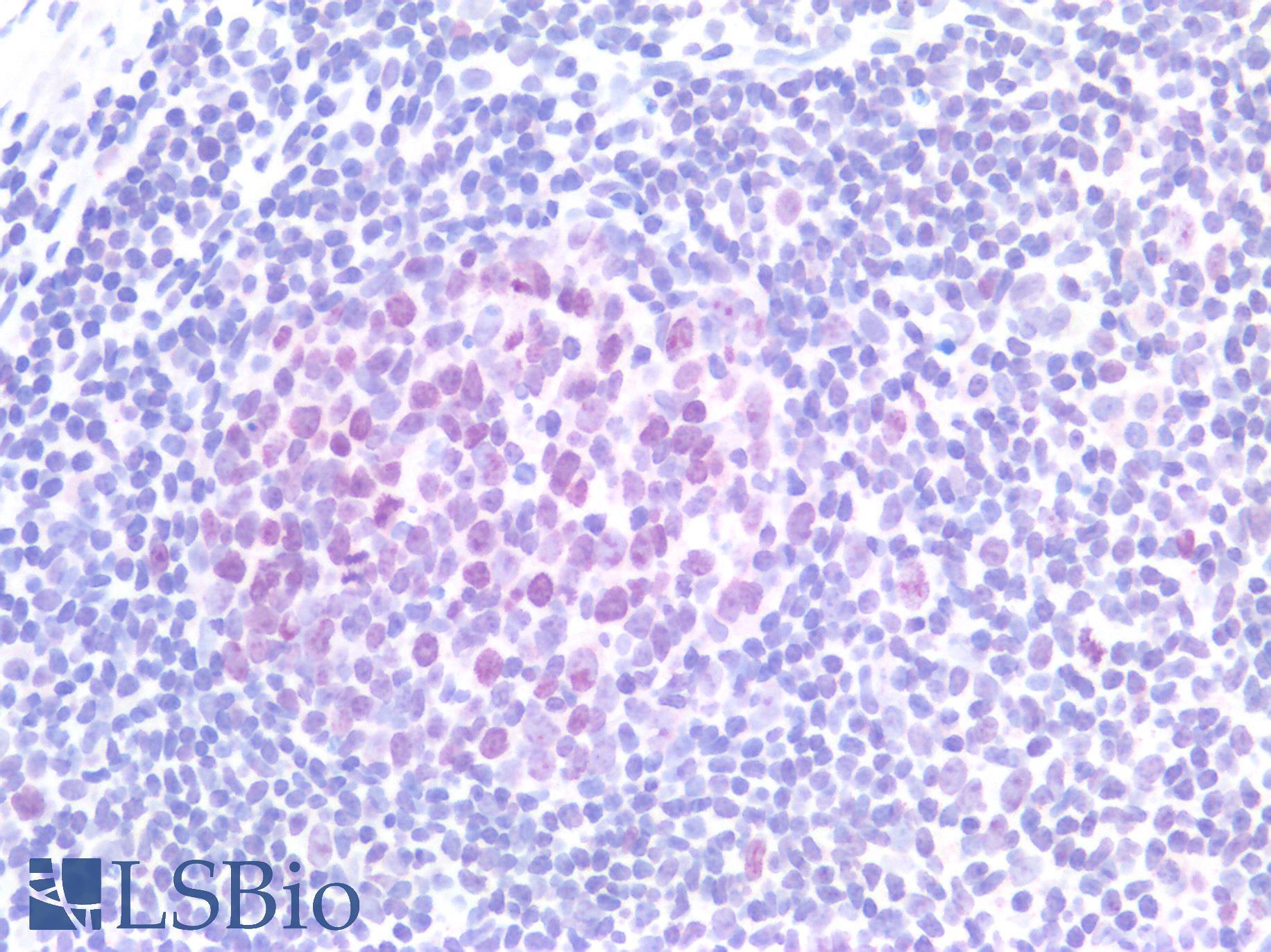 TOP2A / Topoisomerase II Alpha Antibody - Human Tonsil: Formalin-Fixed, Paraffin-Embedded (FFPE)