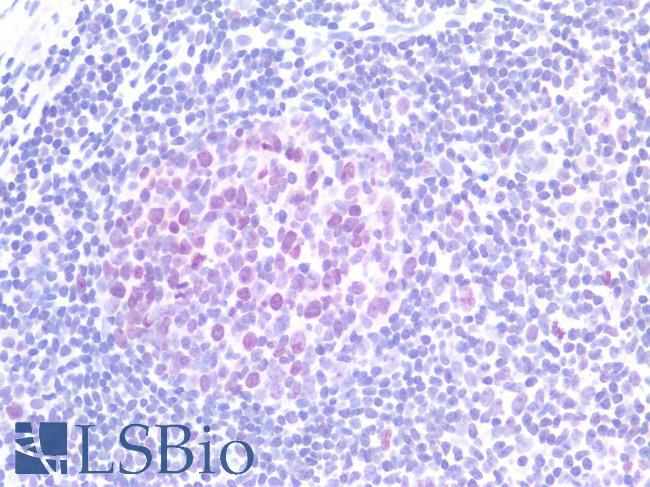 TOP2A / Topoisomerase II Alpha Antibody - Human Tonsil: Formalin-Fixed, Paraffin-Embedded (FFPE)