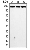 TOP2A / Topoisomerase II Alpha Antibody - Western blot analysis of Topoisomerase 2 alpha expression in MDAMB468 (A); MDAMB231 (B); HeLa (C) whole cell lysates.