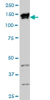 TOPORS Antibody - TOPORS monoclonal antibody clone 5G11 Western blot of TOPORS expression in HeLa NE.